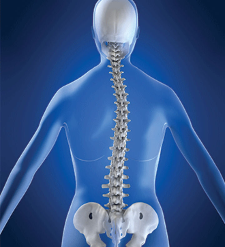 SCOLIOSE ET HYPERCYPHOSE
